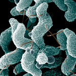 mibi_campylobacter.jpg